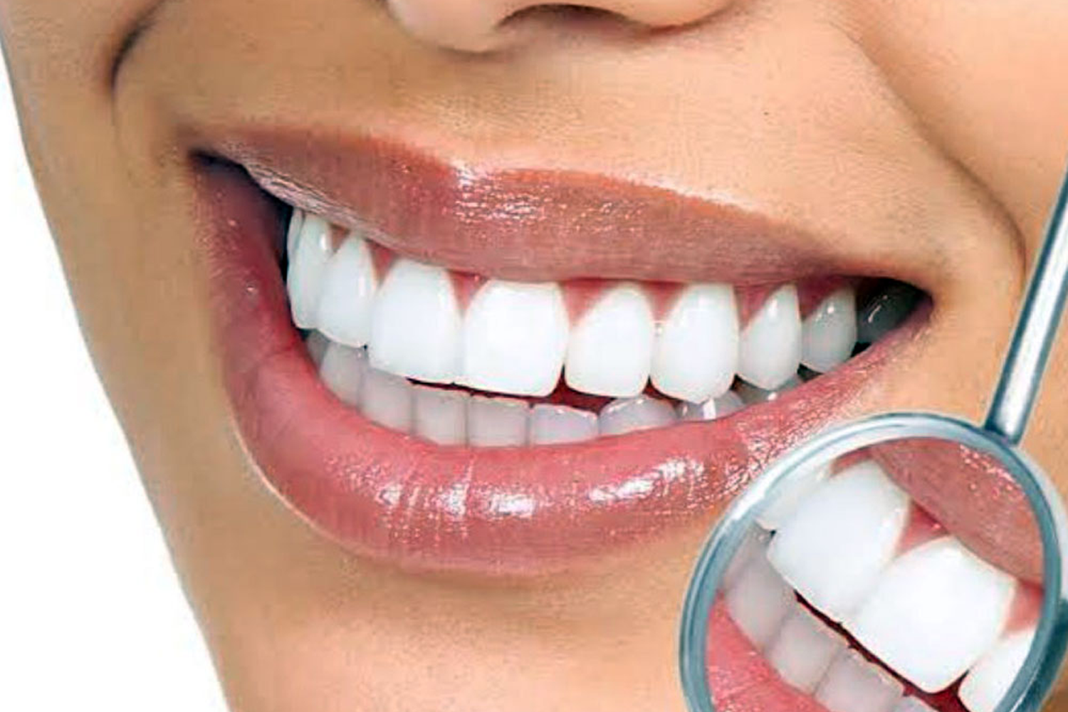 Estetik Diş Ümitköy